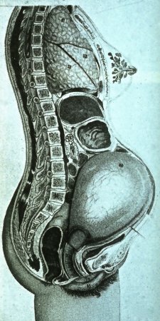 This French anatomical drawing from 1925 depicts a healthy neutral spine