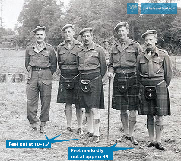 Scottish soldiers, mid-twentieth, showing degrees of foot turnout