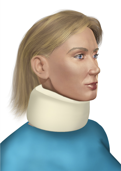 Drawing of woman wearing cervical collar