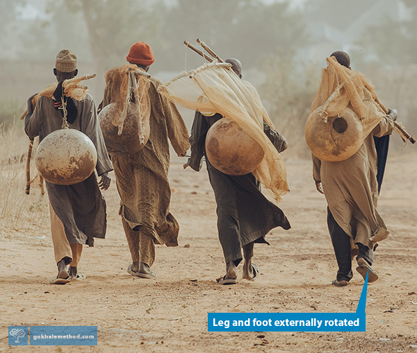 Four African fishermen walking with healthy external rotation in their legs and feet.